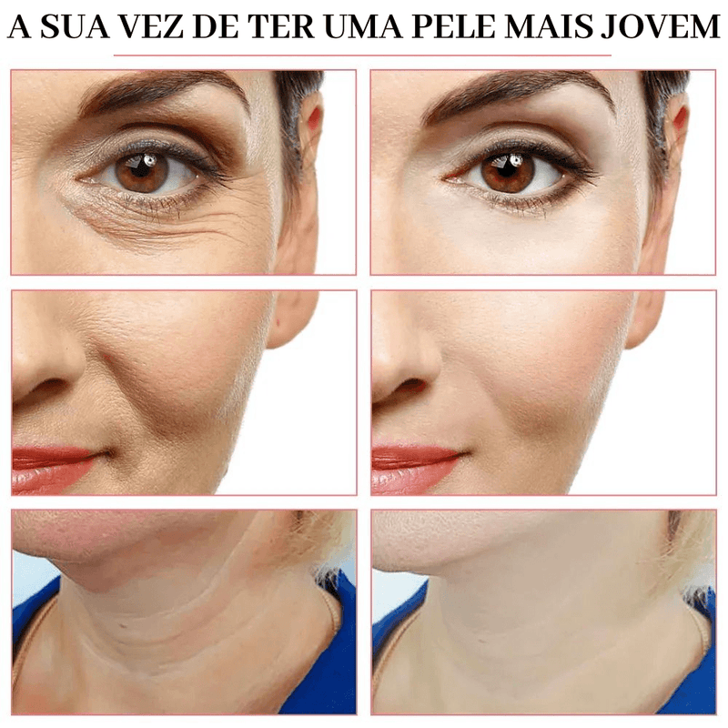 Estimulador Lifting Face Pro Max - 5 EM 1 - ORIGINAL - OfertaExpressa